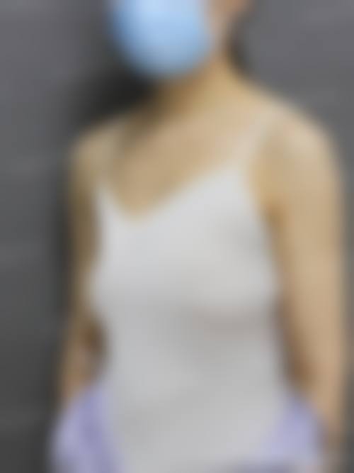 西安妃容医疗美容医生团队经验稳定。