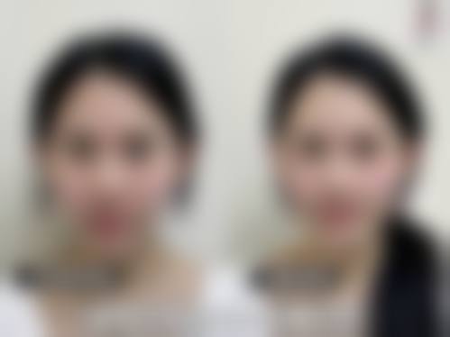广州秀妍医疗美容门诊部2026年价格收费表: