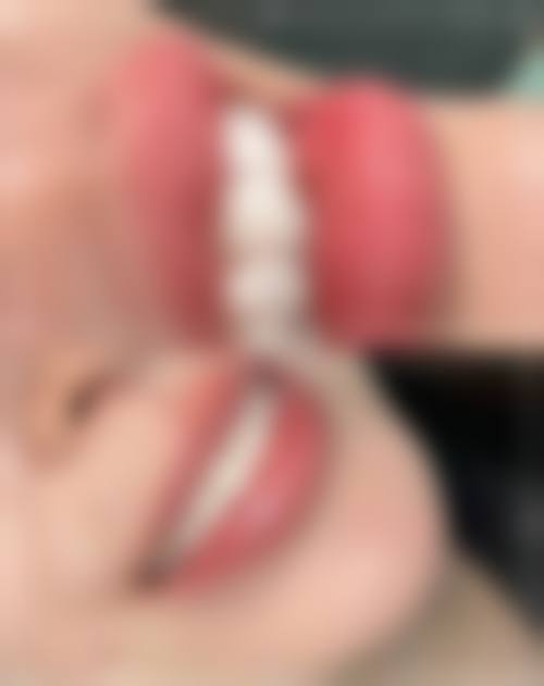 奥伯伦口腔门诊部治疗反馈与口碑评价。