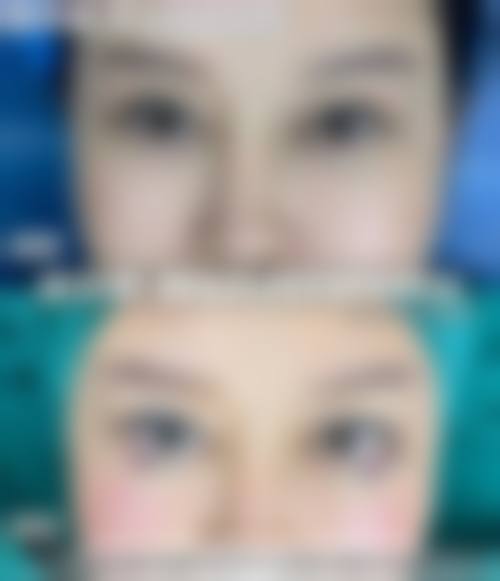宁夏宝石花医院眼科治疗反馈与口碑评价。