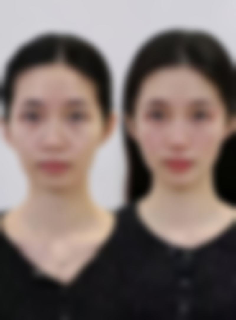 二、吴豫芳医生擅长项目