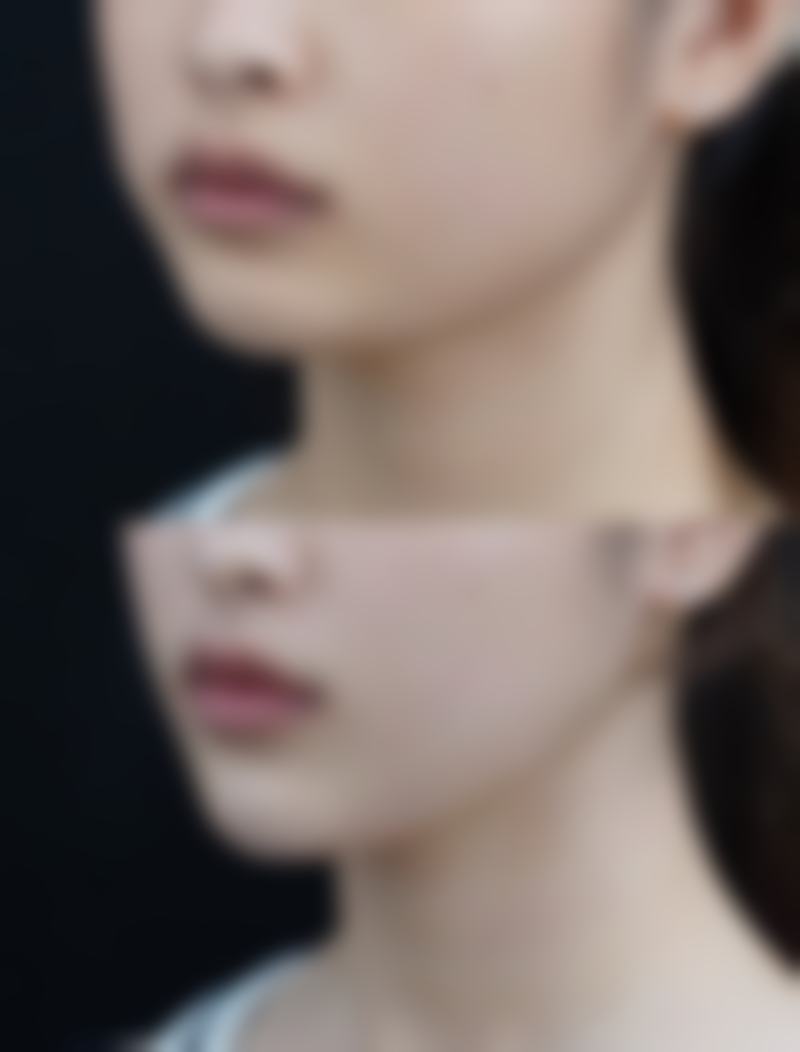 1. 熱瑪吉FLX全臉