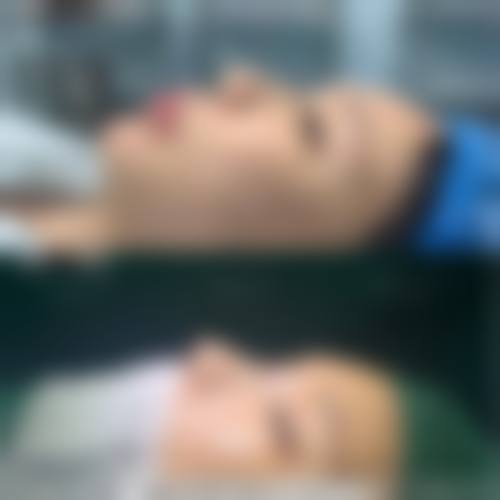 三、洪伟强医生技术水平优势
