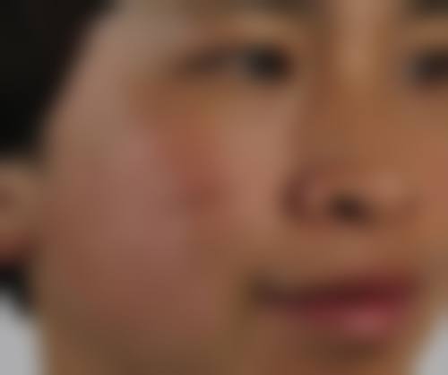 三、长沙芊亿医疗美容门诊部开展项目及特色技术