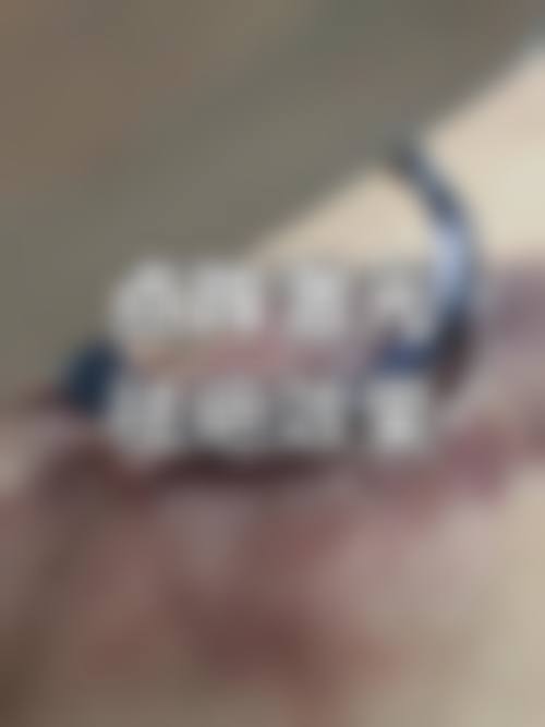 南昌艺生植发医院擅长项目。