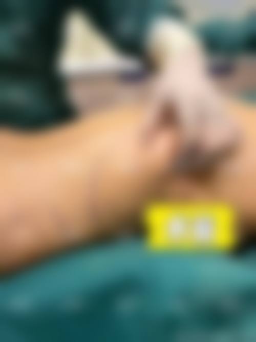 临床实例分享:吴亮医生的真实诊疗故事