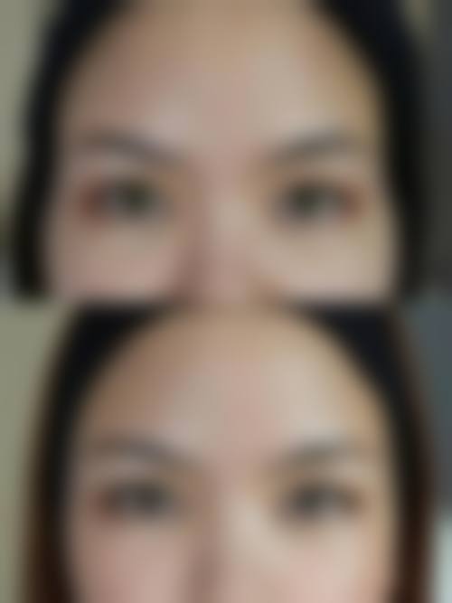 杭州妃妮施医疗美容诊所擅长项目。