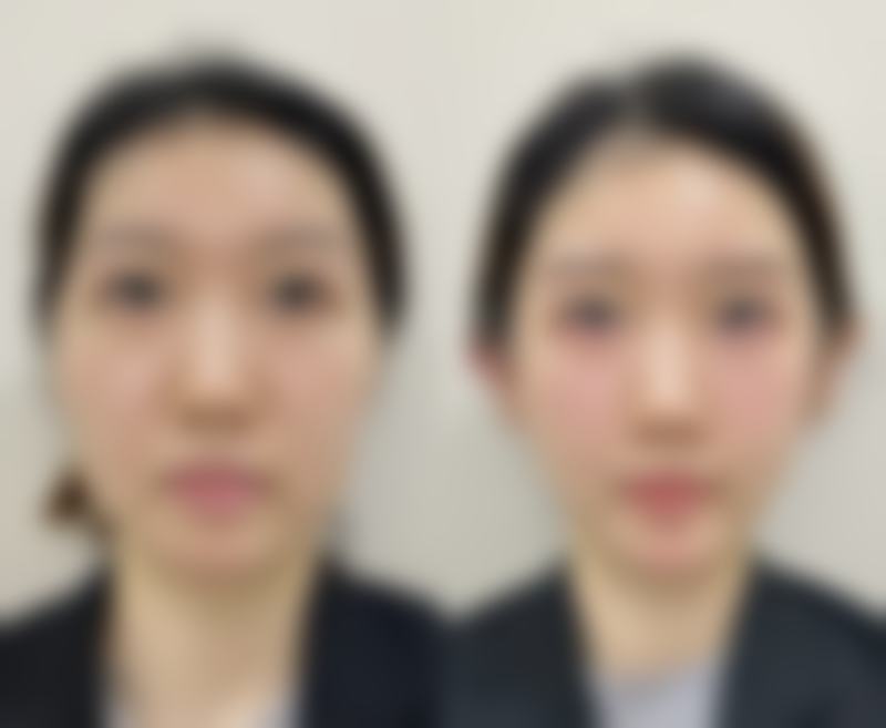 韓國鎖恩愛女性私密整形醫院怎麼預約掛號？2026預約攻略：3步輕鬆預約+避坑指南大公開