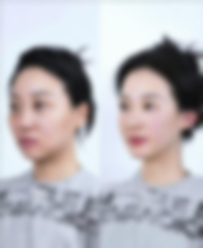 韓國MULY妙麗整形醫院價格表2026中韓報價:安心要點——港澳姊妹必睇!