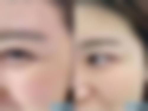 5. 韓國世金整形醫院怎麼預約掛號 常見陷阱大公開（唔使再踩雷！）