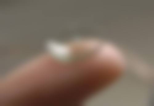 广西壮族自治区民族医院眼科口碑如何