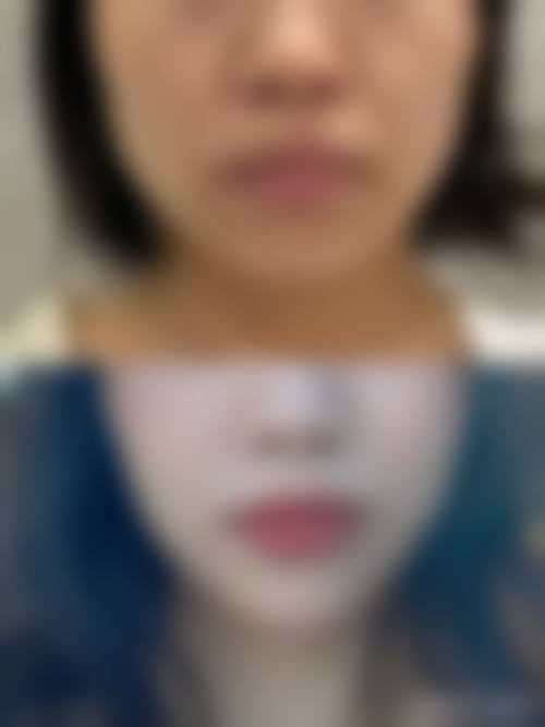 北京可丽亚整形医院医生团队经验稳定。