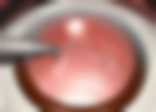 三门峡市中 心医院眼科预约挂号方式。