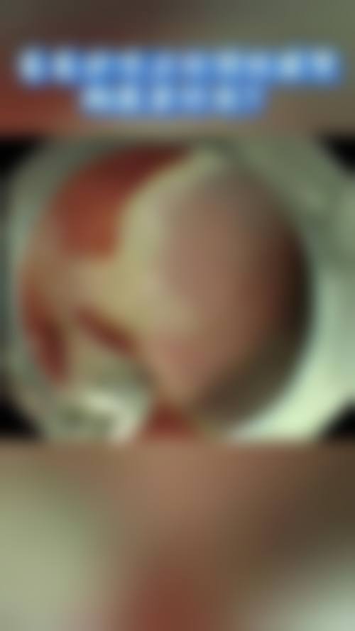 七、拉萨莱希整形医院口碑如何