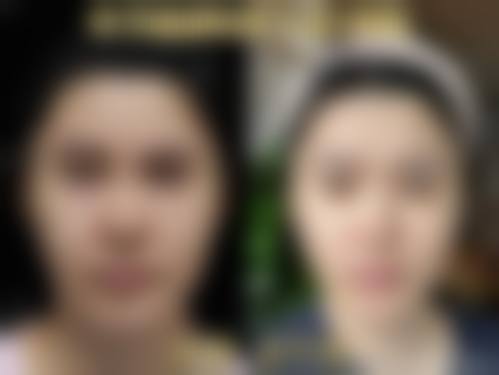 邯郸市非常好医院治疗反馈与口碑评价。
