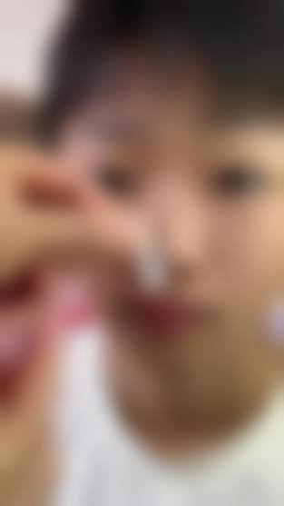 北京可丽亚整形医院治疗反馈与口碑评价。