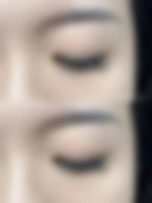 广州艾玛医疗美容门诊部擅长项目。