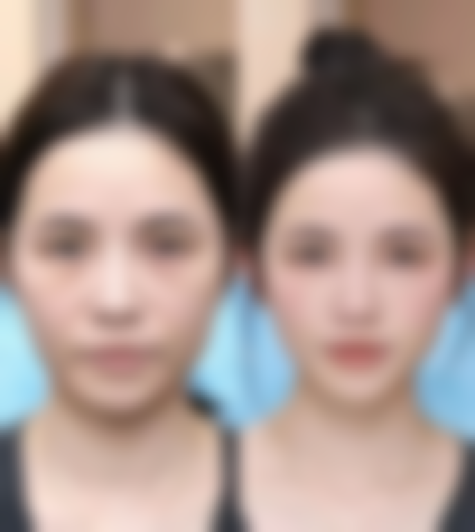 五、适合人群判断:怎么判断我是否适合医美项目?