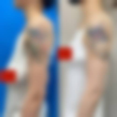 六、杭州爱度医疗美容诊所微整形技术优势