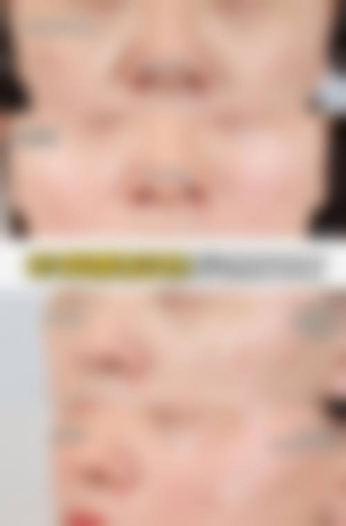 晋中榆次德尔美客四维医疗美容诊所预约挂号方式。