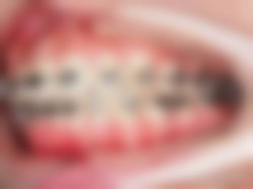 江苏南通薄荷博士口腔连锁治疗反馈与口碑评价。