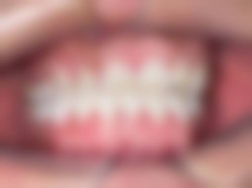 昆山君子亭口腔擅长项目。