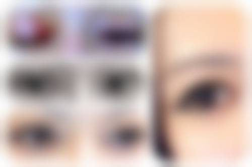 五、太原美诗沁医疗整形美容真实实例参考