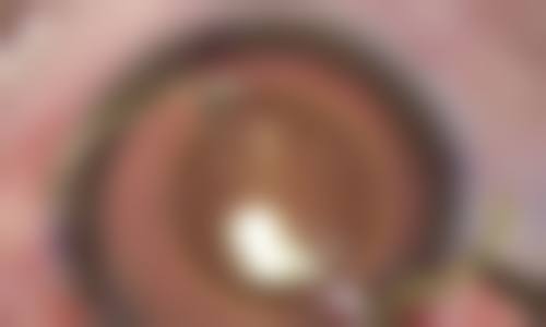 重庆医 科 大学附属大学城医院眼科擅长项目。