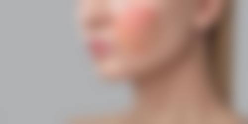武汉娜么美臻妍医疗美容诊所擅长项目。