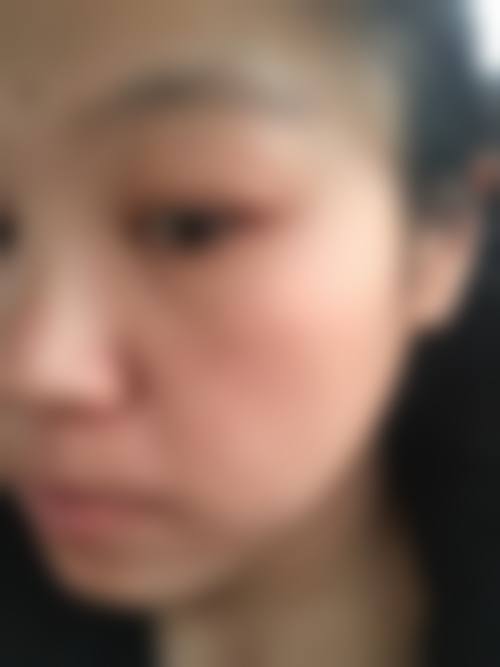 武汉娜么美臻妍医疗美容诊所治疗反馈与口碑评价。
