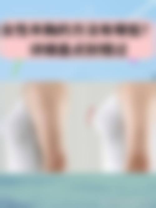 临床实例分享