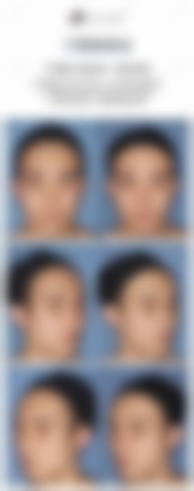 鞍钢集团总医院医疗美容医院的特色项目