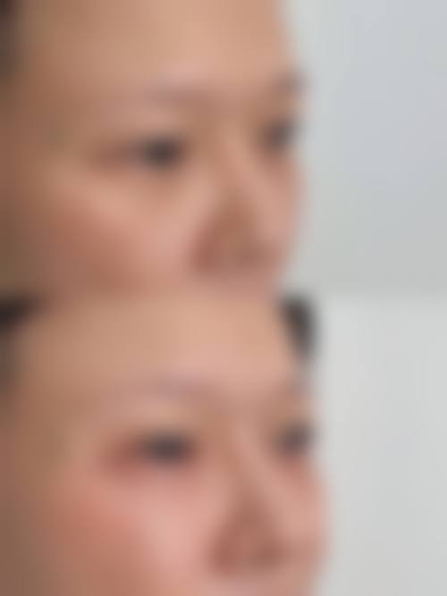 特色项目与技术优势：精细塑美，成效自然