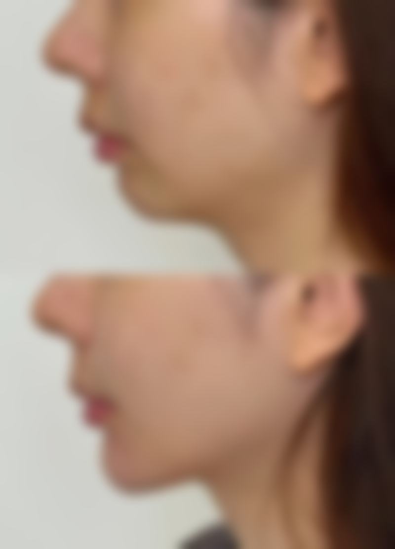 怀特整形医院治疗反馈与口碑评价
