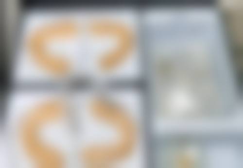 韓國ID醫院價格貴唔貴 適合邊類人群?