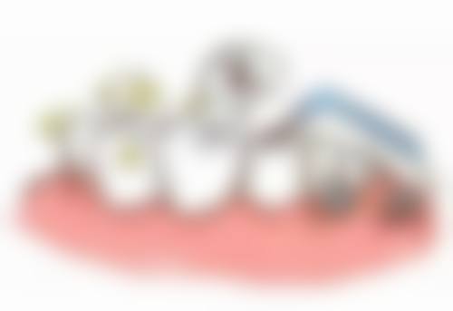 深圳佳美口腔香港人評價:醫生技術邊個更掂?