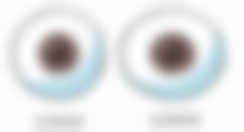 六、眼角膜眼镜价格一般多少
