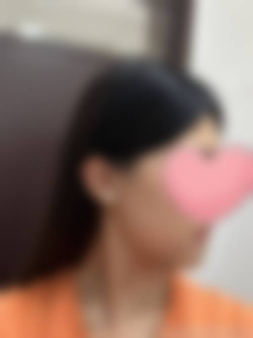 广州沁颜时尚医美门诊部治疗反馈与口碑评价。