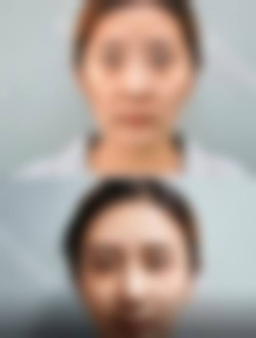 广州酷乐贝儿整形医院治疗反馈与口碑评价。