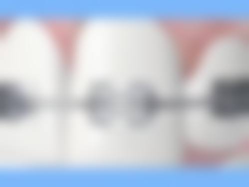 广东省中山兴华口腔预约挂号方式。