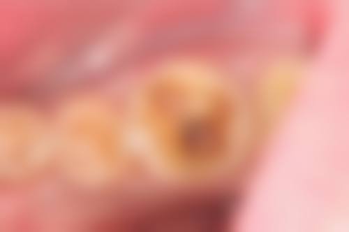 广东省中山兴华口腔地理位置便于到院。