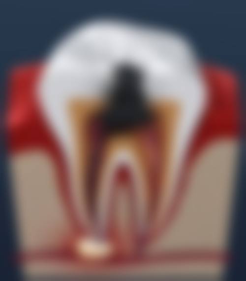 结尾预约号召