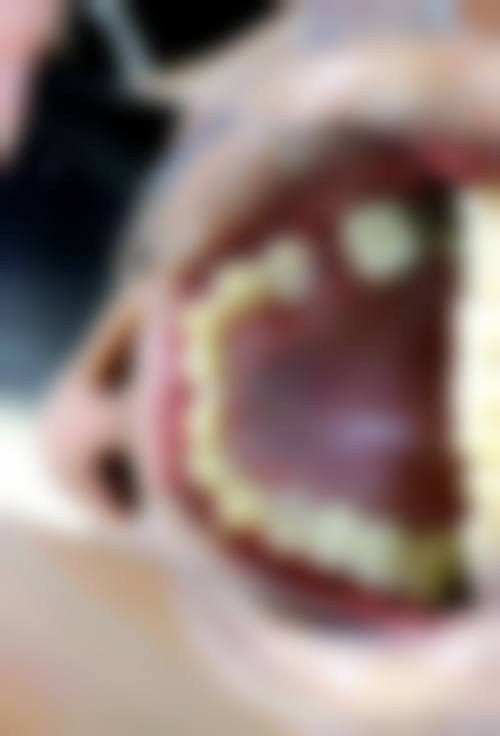 邓昊医生的技术实力