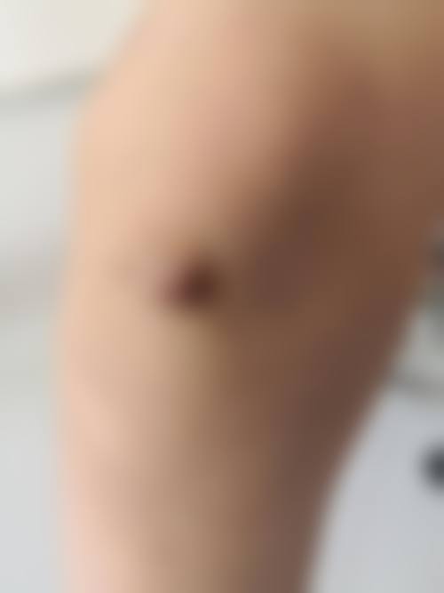三、开封汴美整形医院核心技术与诊疗优势