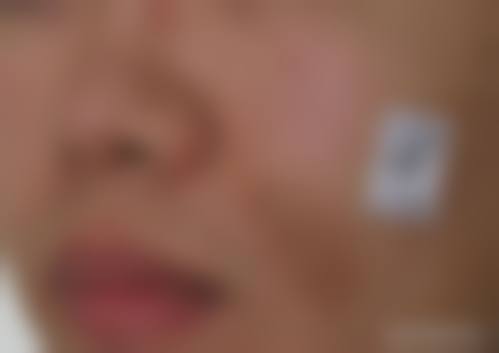 八、患者常见问题解答(精选 )