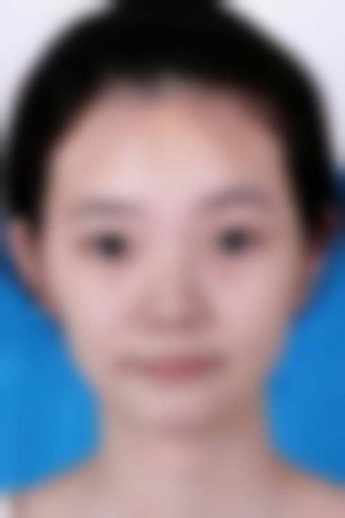 擅长项目详解