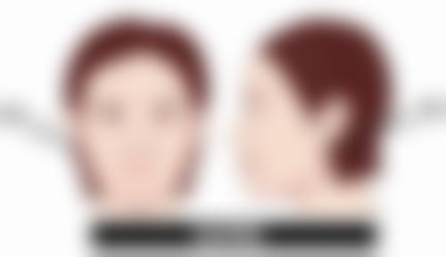 拓展延伸:韓國View項目真相 + 關鍵選擇點 + 避坑指南