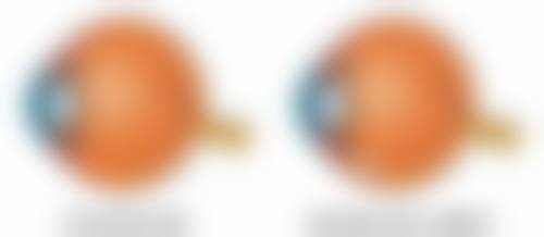 韓國珠兒麗Jewelry整形醫院價格表2026中韓報價 術前術後避坑指南(港澳姊妹必睇)