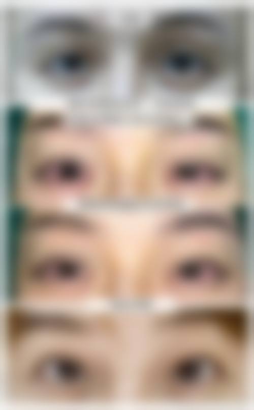 十一、广州南珠整形美容中 心真人口碑实例评价一览