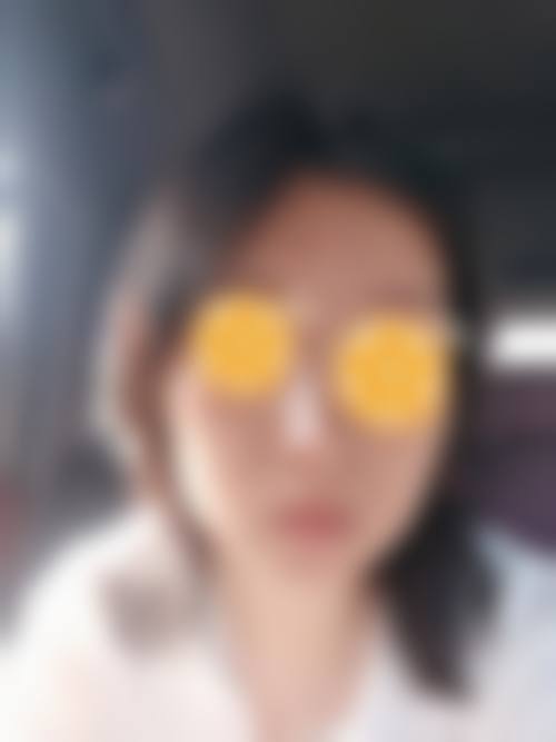 韩国DI整形外科医院治疗反馈与口碑评价。
